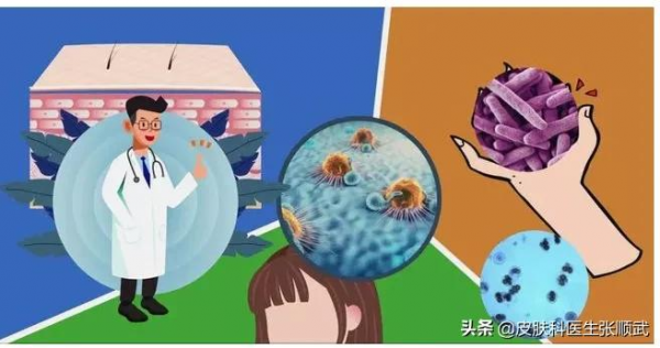 大腿根紅了一片特別癢，抹藥不好反而傳染到脖子上了