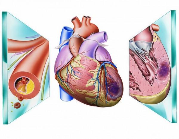麝香保心丸,增加冠脈供血抗心絞痛,促進心肌血管再生,保護心臟 麝香保心丸,增加冠脈供血抗心絞痛,促進心肌血管再生,保護心臟