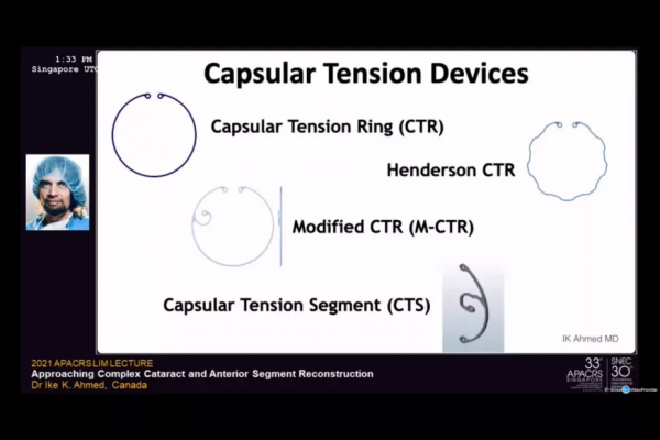 手術刀尖上的舞者——走近複雜的眼前節手術 手術刀尖上的舞者——走近複雜的眼前節手術