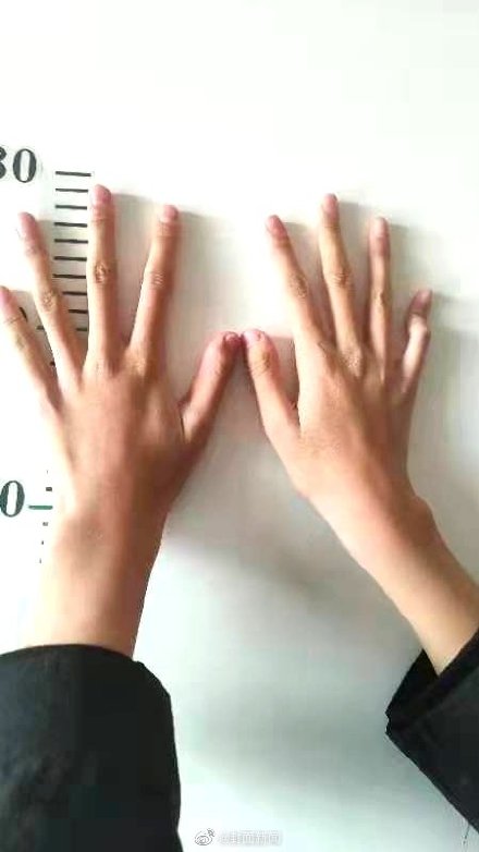 13歲女孩身高1米82急哭媽媽：女兒呀，你慢些長