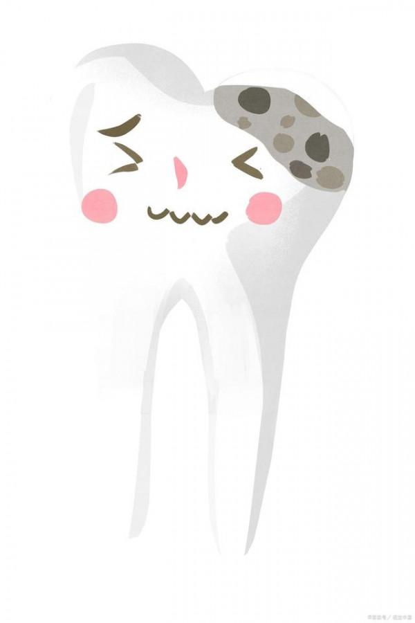 齲病的相關知識與治療