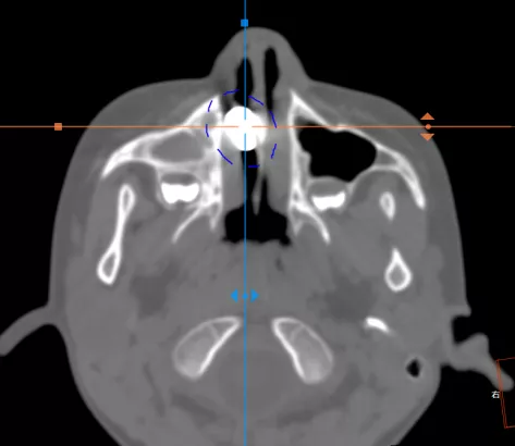 一份放射科醫師的值班日記，告訴你兒童意外傷害有多可怕