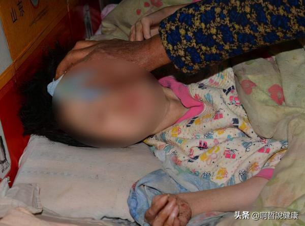 悲劇！7歲小腦萎縮，目前已經生活無法自理