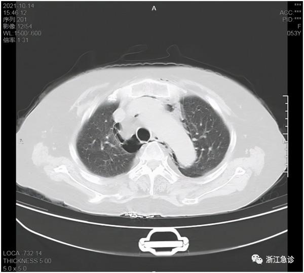 小小面板紅腫，也可能是致命的疾病！這一類皮下感染不要疏忽