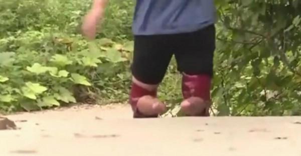 他因一次打架精神失常，離家時四肢健全，回家時雙腳已被卸下