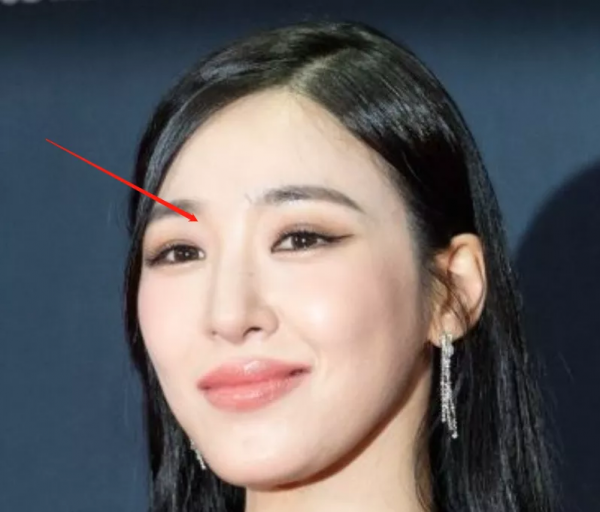 好多整容臉！外網曝韓國頒獎禮生圖，明星動鼻子後遺症太明顯