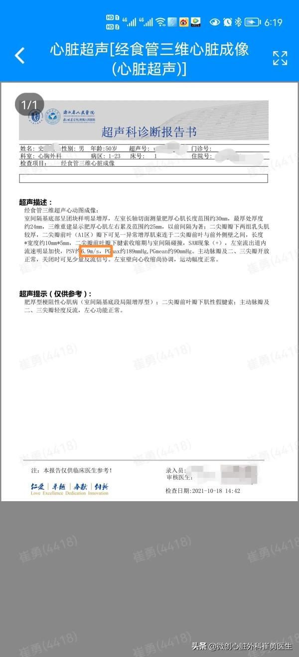 無可見疤痕的微創肥厚梗阻性心肌病手術 無可見疤痕的微創肥厚梗阻性心肌病手術