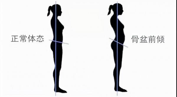 別焦慮了！那些有小蠻腰的人，必定會有小肚子