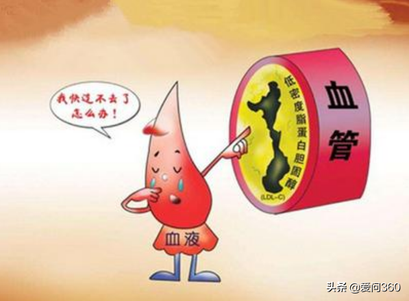 甘油三酯為什麼會高？這些因素是主因，預防三脂高的方法要牢記