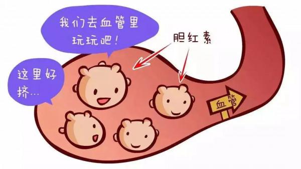 孕期手掌腳掌癢咋回事? 孕期手掌腳掌癢咋回事?