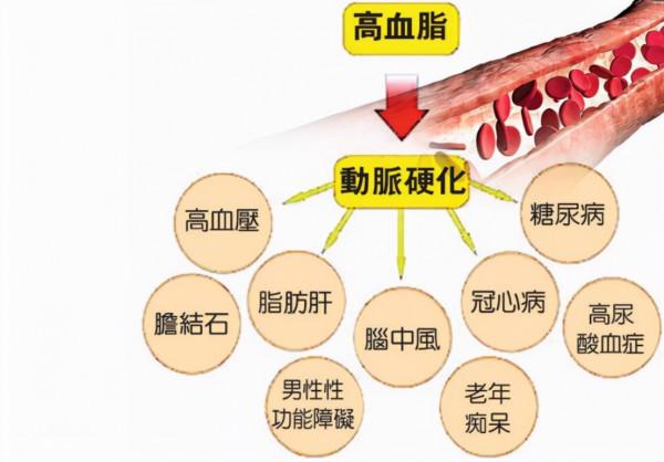 血脂康降脂效果與他汀相當，保護血管，改善胰島素抵抗
