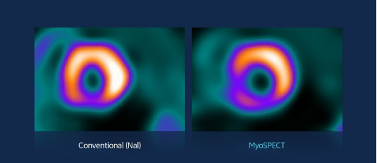 聚焦心臟！GE推出新一代核醫學掃描器