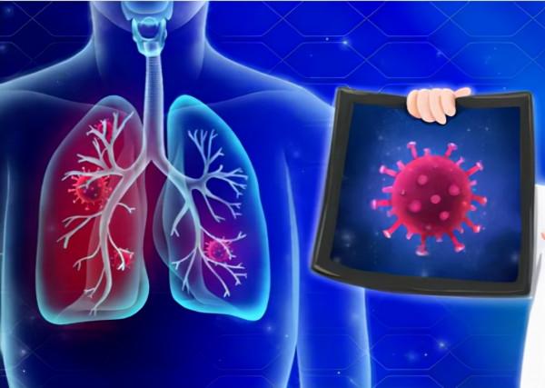 新冠後遺症是什麼樣子？《柳葉刀》交出答案，給所有人提了個醒