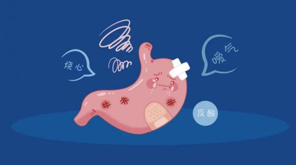 總是反酸燒心,十有八九是這個病!很多人以為是慢性咽炎 總是反酸燒心,十有八九是這個病!很多人以為是慢性咽炎