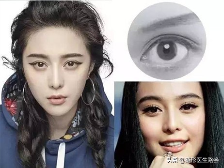 從事醫美整形工作30+年，談談我眼中的男女審美差異？