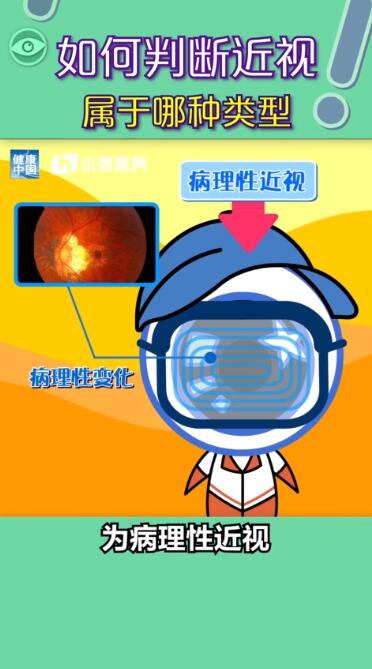 孩子近視都是電子產品惹的禍？近視有沒有可能恢復？權威解答在此，值得收藏