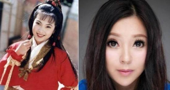 越整越難看後遺症一堆的9位女星！臉像鞋拔子，不敢做大表情