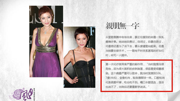 娛樂圈這8位女星被整容毀掉，有人臉僵如石，有的“堪比換頭”