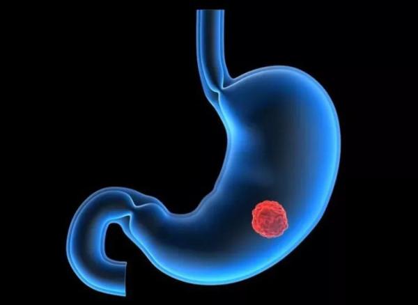 癌症痛苦程度排行榜，排名前十的都有哪些？