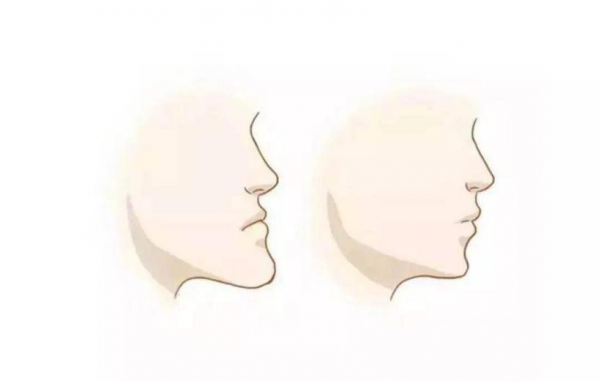 論“嘴突”的那點事兒 論“嘴突”的那點事兒