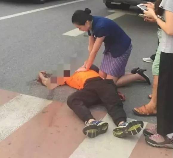 “人工呼吸”是向著患者口中吹氣還是吸氣？原理是什麼？一文讀懂