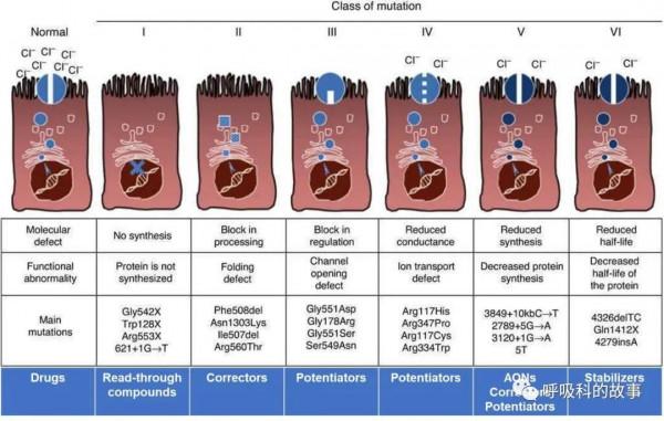 反覆發作鼻竇炎、咳嗽、支氣管擴張,這個病我們要提高認識 反覆發作鼻竇炎、咳嗽、支氣管擴張,這個病我們要提高認識