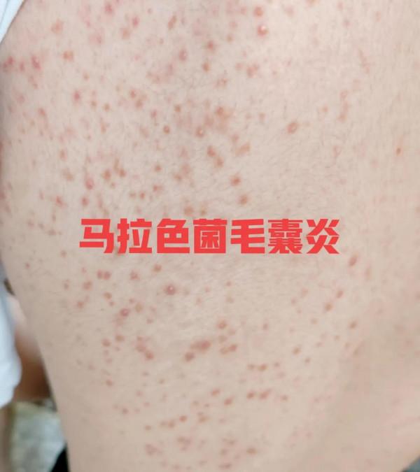 4種常見的面板病,教你最實用的識別和處理方法 4種常見的面板病,教你最實用的識別和處理方法