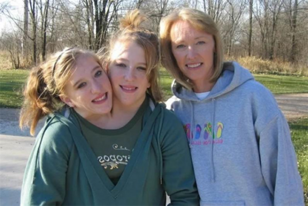 雙胞胎女嬰腹部相連醫生都說活不了，4歲做分離手術如今已滿20歲