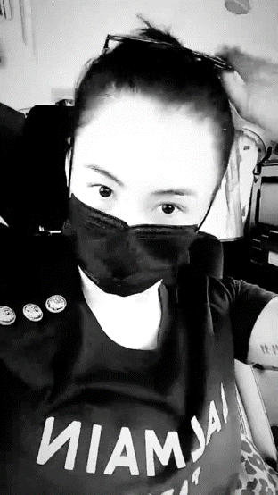 張柏芝被3歲小兒子抓傷臉部，傷口較長且深像刀疤一樣遮都遮不住