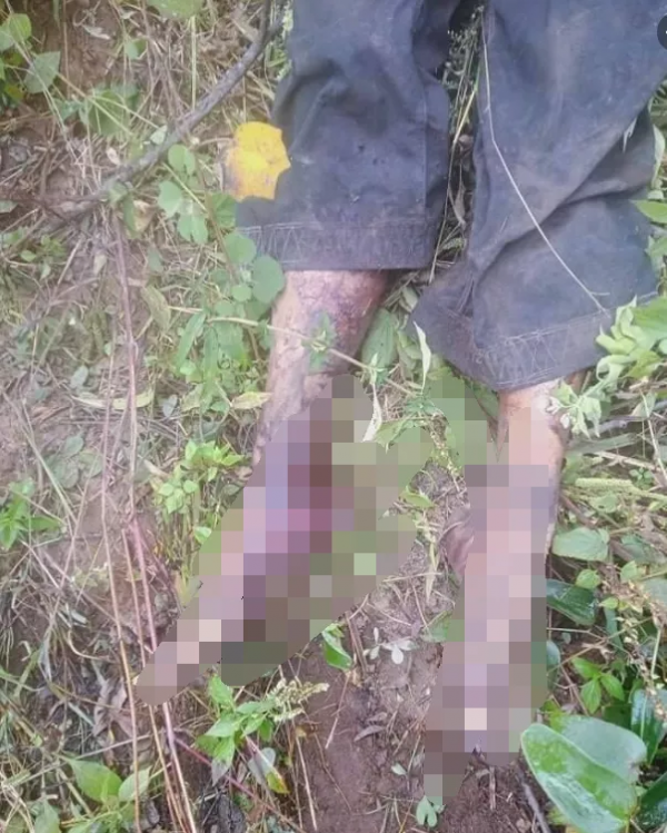 緬北臘戌父子外出砍竹子發生悲劇，父親當場身亡