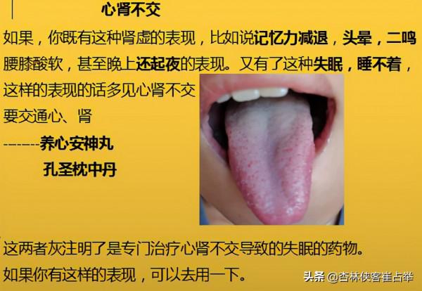 治療失眠的中成藥大總結,失眠、多夢、入睡困難再也不怕用錯藥 治療失眠的中成藥大總結,失眠、多夢、入睡困難再也不怕用錯藥