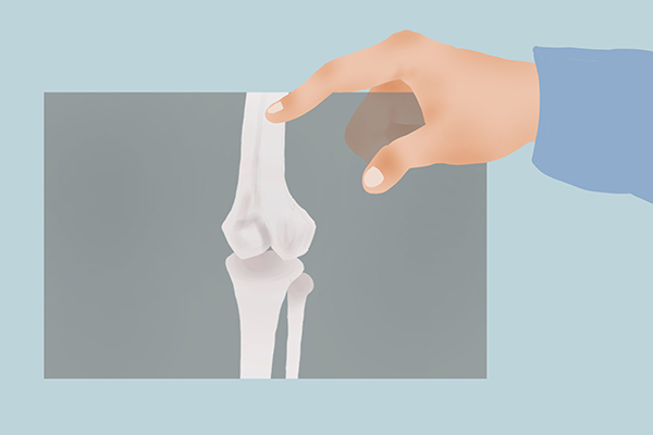 堅持快步走，能多活15年？47萬人的研究，給出了答案