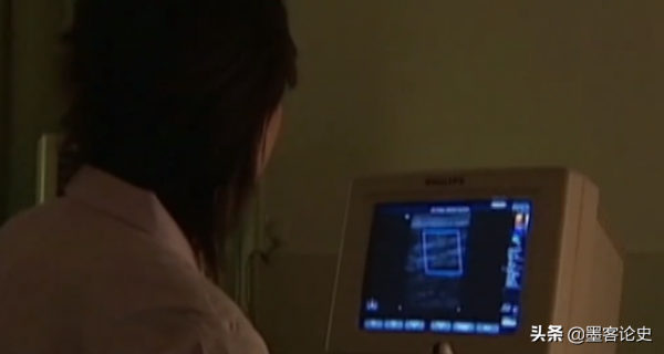 江西8歲女孩患血管瘤，下巴長出長舌狀肉瘤，隨年齡增長垂吊胸前