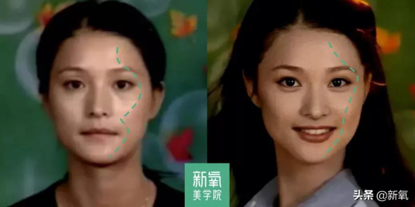 范冰冰接班人離開濾鏡一秒認不出,魚頭泡餅臉如何自救? 范冰冰接班人離開濾鏡一秒認不出,魚頭泡餅臉如何自救?