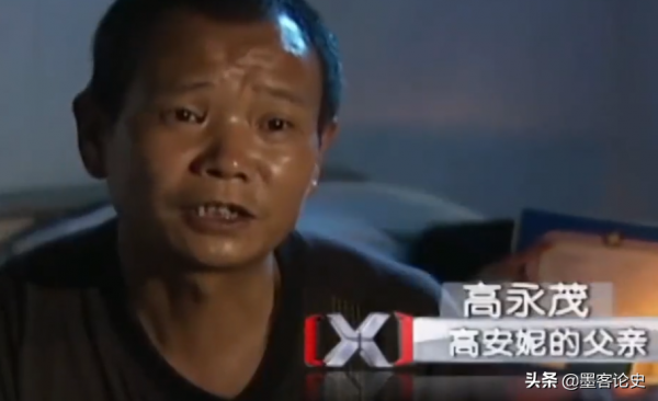 江西8歲女孩患血管瘤，下巴長出長舌狀肉瘤，隨年齡增長垂吊胸前