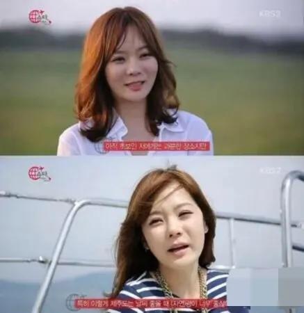 整容後遺症有多可怕?當年爆紅的初代韓流明星,現在臉都認不出 整容後遺症有多可怕?當年爆紅的初代韓流明星,現在臉都認不出