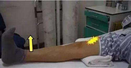 膝關節術後股四頭肌康復訓練