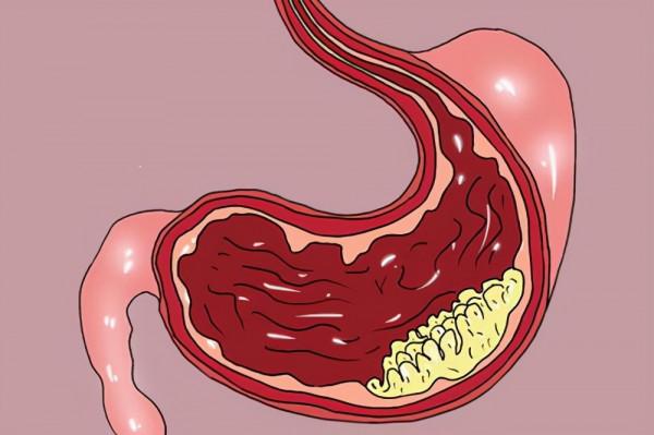 癌症真的會“遺傳”嗎？