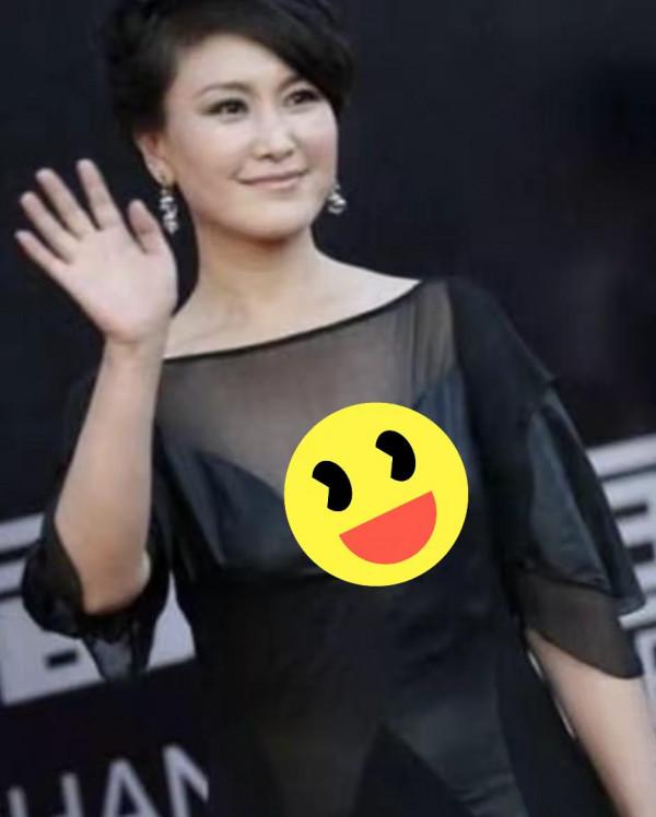 越整越難看後遺症一堆的9位女星！臉像鞋拔子，不敢做大表情