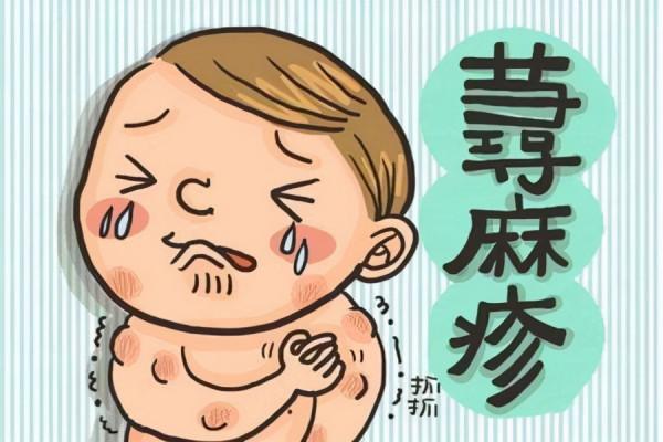 蕁麻疹俗稱:冷飯疙瘩 患上後你知道怎麼治療嗎? 蕁麻疹俗稱:冷飯疙瘩 患上後你知道怎麼治療嗎?