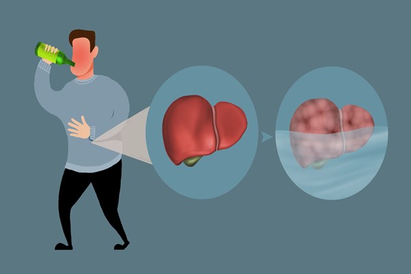 喝酒可以養生?柳葉刀:最安全的飲酒量就是不喝酒 喝酒可以養生?柳葉刀:最安全的飲酒量就是不喝酒