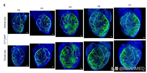 周斌&sol;駱清銘合作揭示哺乳動物新生期心臟冠狀動脈生成新機制