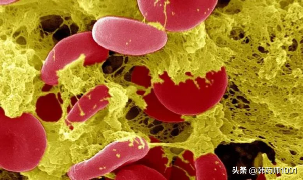 吃了降壓藥，血壓還是很高，這是怎麼回事？