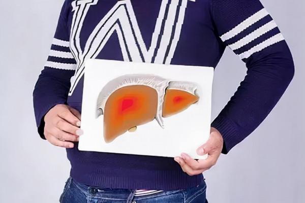 肝病患者春節&OpenCurlyDoubleQuote;四怕&rdquo;