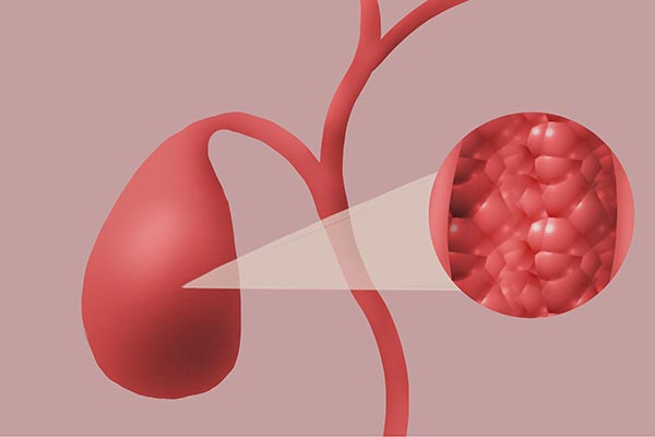 吃素養生，卻吃出一肚子結石，咋回事？年過60，怎麼吃才能長壽？