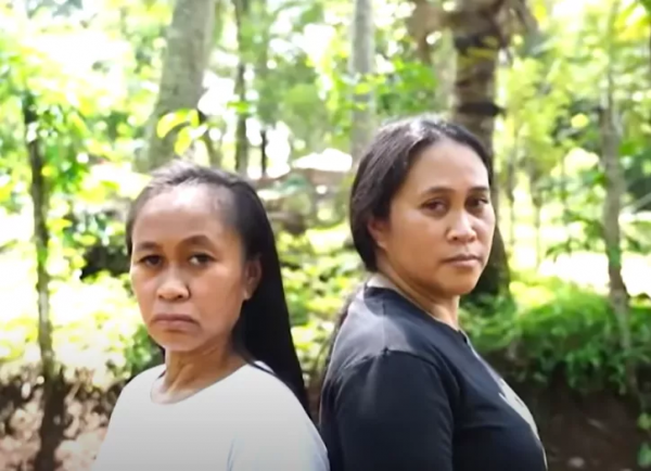 16歲菲律賓少女迅速衰老成60歲老人的臉,尋遍醫生後找出心酸病因 16歲菲律賓少女迅速衰老成60歲老人的臉,尋遍醫生後找出心酸病因