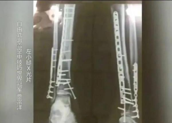 男足，看看武大靖的腳，賈宗洋的腿，你們還有啥理由不努力