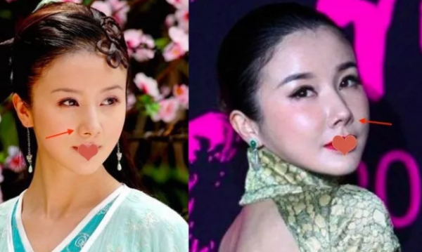 內娛“假鼻子”大PK，誰的假到逆天，誰的越整越殘？