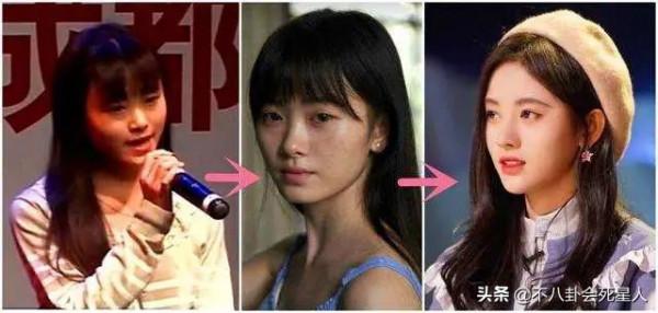 那些亂整鼻子的女明星還好嗎？後遺症一大堆，楊冪金晨都開始崩了