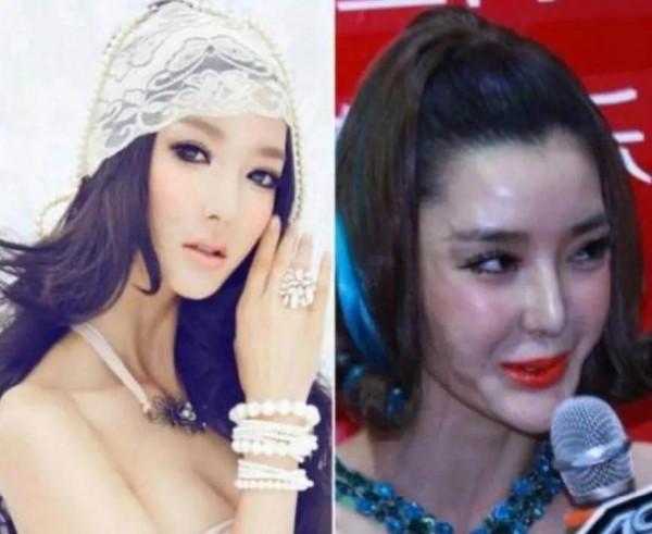 整容失敗的幾位明星